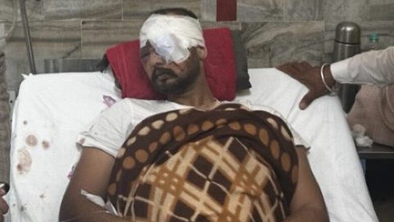 Three farmers lost eyesight due to pellet injuries: Officials