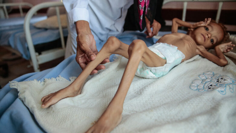 Millions of Yemenis at risk of famine due to ongoing war: UNICEF