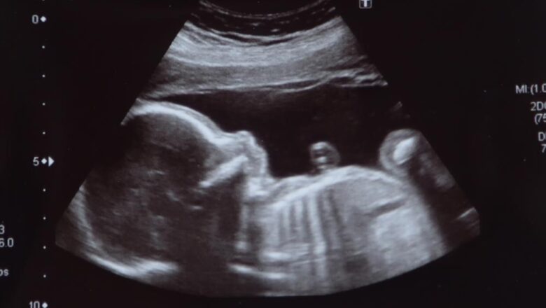 Srinagar family accuses private diagnostic centre of playing with lives by showing ‘wrong’ results