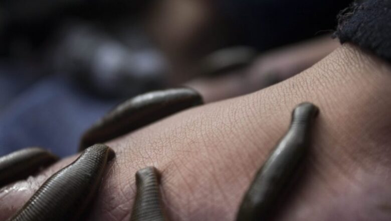 Centuries-Long Leech therapy continues on Novroz Eve in Kashmir