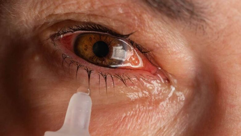 ‘Decline in Jammu division, surge in Kashmir’: Over 26,000 ‘eye flu’ cases in J-K